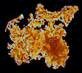Microscopic View of Iron Bacteria Removal